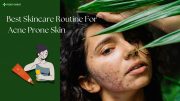Acne Prone Skin care