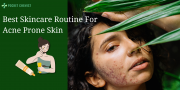 Acne Prone Skin Care